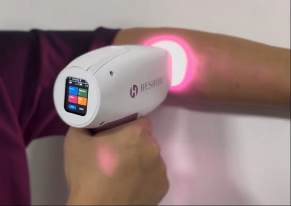 Unexpected Ways to Experience 4 Wavelength Diode Laser Hair Removal